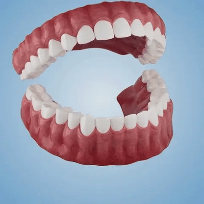 👑2026 Hot Sale Ends Today: 70% OFF! Custom Custom-Fit Full Functional Dentures Make you more confident – Made in the USA