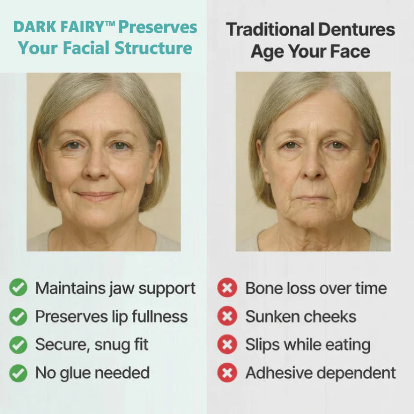👑2026 Hot Sale Ends Today: 70% OFF! Custom Custom-Fit Full Functional Dentures Make you more confident – Made in the USA